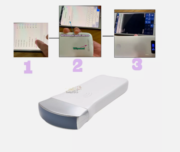 3.5-5MHZ Wireless Ultrasound Probe WIFI Scanner 128 Element For iOS Android Win - Image 4