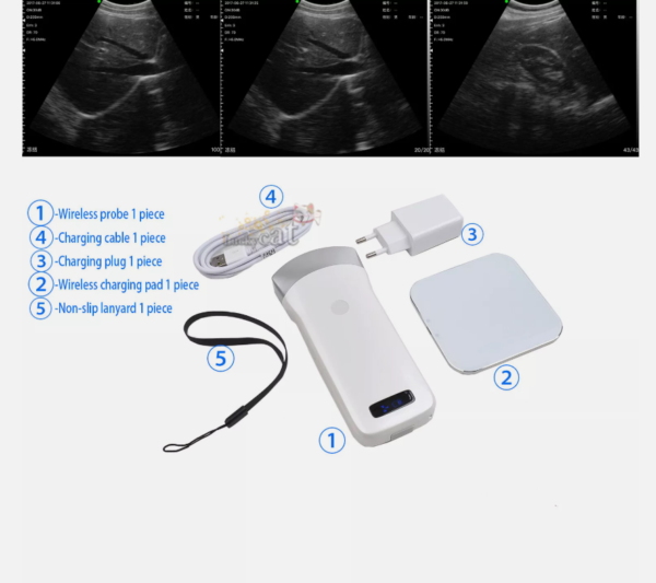 Full Digital Wireless Probe Mobile Phone Ultrasound 3.5/5.0mhz for Apple/Android - Image 3