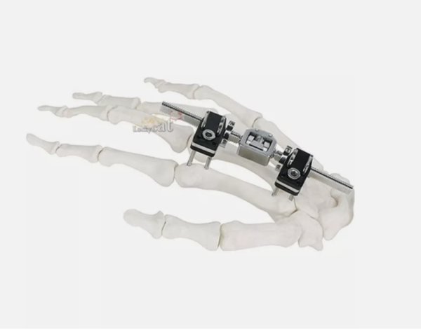 Mini Fragment External Fixator Orthopedic Implant Ilizarov External Fixation - Image 2